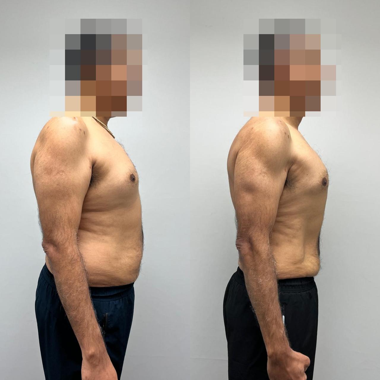 Perdeep Kumar's transformation 2